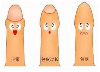 包茎图片